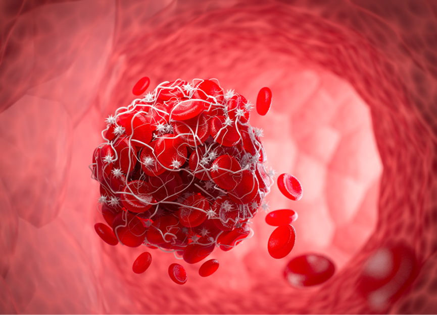 mRNA takes aim at deadly clots