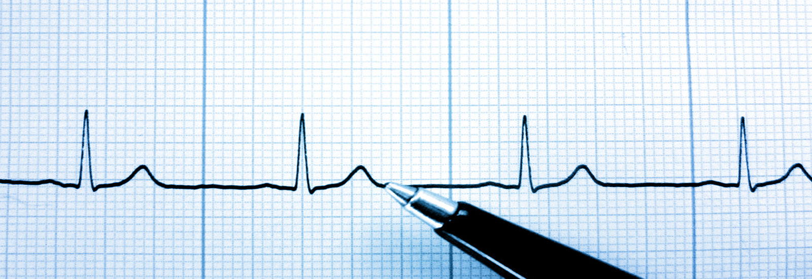 Echocardiography service