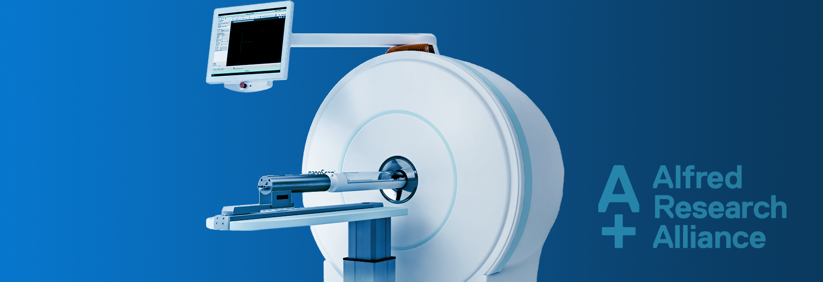 PET-CT (ARA-MBI)