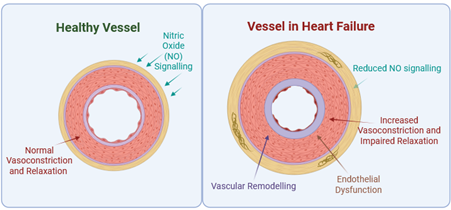 Vascular dysfunction in heart failure
